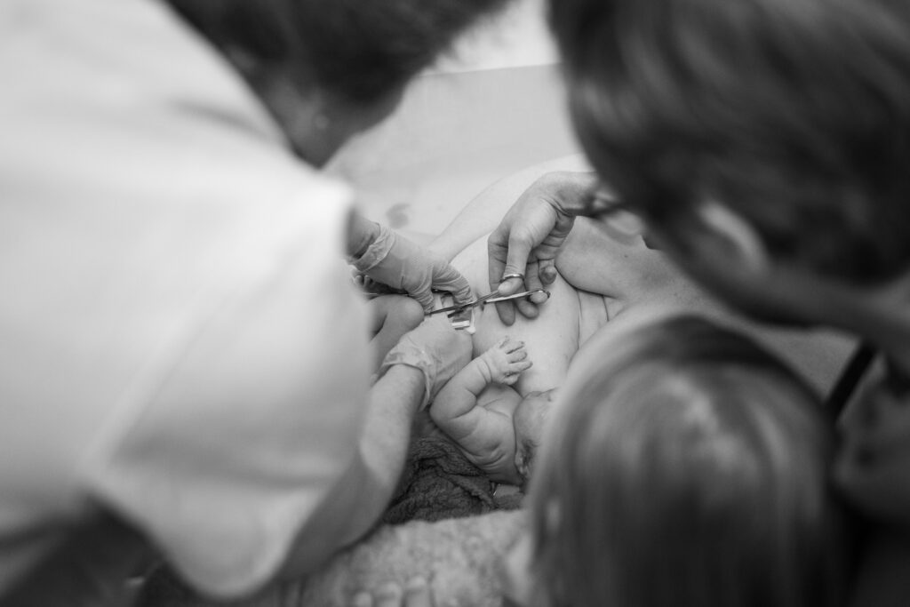 Greensboro Birth Photographer - Cutting the umbilical cord during home birth